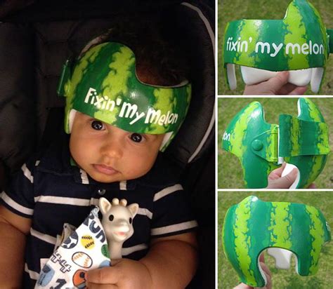 20 Cute And Fun Helmets For Babies With Plagiocephaly Baby Helmet