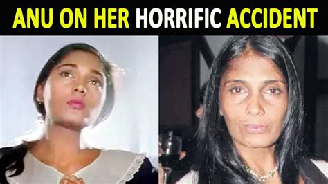 aashiqui actress anu aggarwal opens up about her horrific accident in 1999 youtube