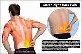 Cause Of Pain In Lower Back Left Side