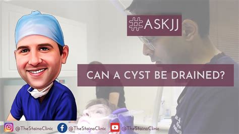 Can You Drain A Cyst Youtube