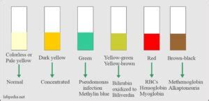 Urine Physical Examination And Interpretation Labpedia Net