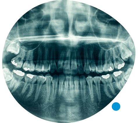 Radiología Dental Dentametrics