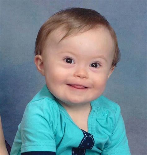 Baby Jude On His Birthday ♥ Down Syndrome Awareness Downs Down