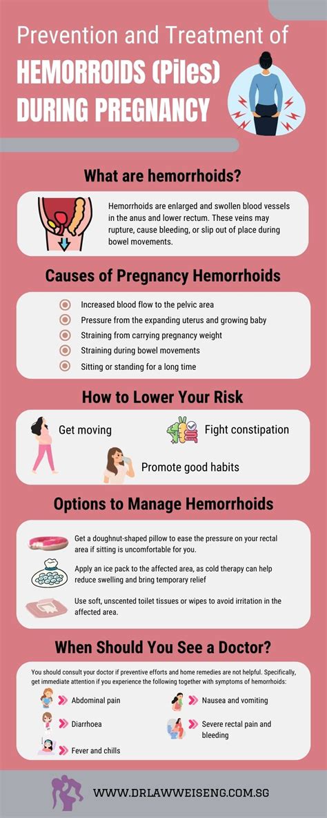 Prevention And Treatment Of Hemorrhoids Piles During Pregnancy
