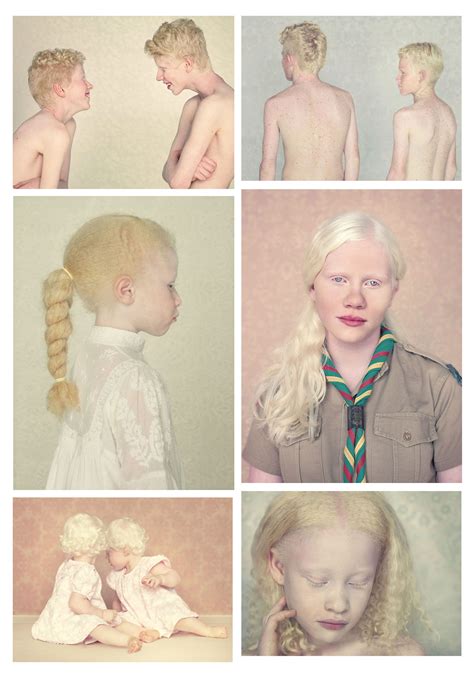 Albinos Gustavo Lacerda Fotos Rosto Pessoas Bonitas