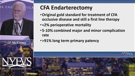 Endarterectomy Remains The Gold Standard For Cfa Treatment J F Mckinsey