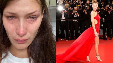 model bella hadid opens up on her daily struggle with depression and anxiety verve times
