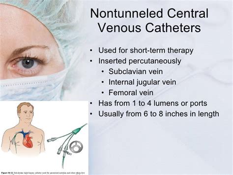 Surgical Drains Tube Catheters And Central Lines