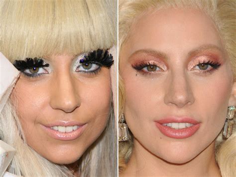 Lady Gaga Before And After The Skincare Edit