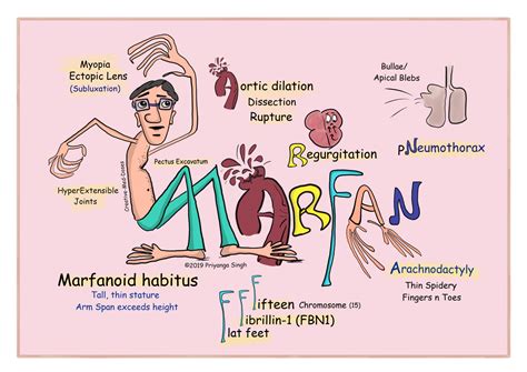 Marfan Syndrome Quick Review Creative Med Doses