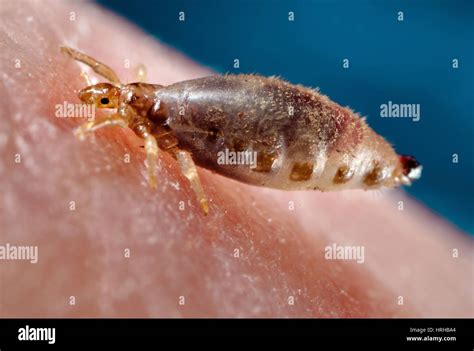 Body Lice Hi Res Stock Photography And Images Alamy