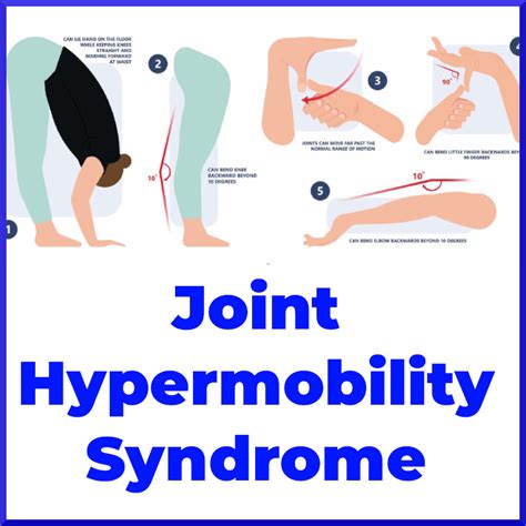 Understanding Hypermobile Ehlers Danlos Syndrome Eds 50 Off