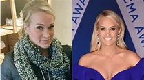 See a Photo of Carrie Underwood Post Face Injury | Heavy.com