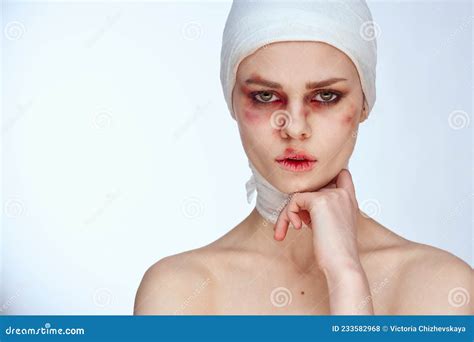 Woman Facial Injury Health Problems Bruises Pain Isolated Background