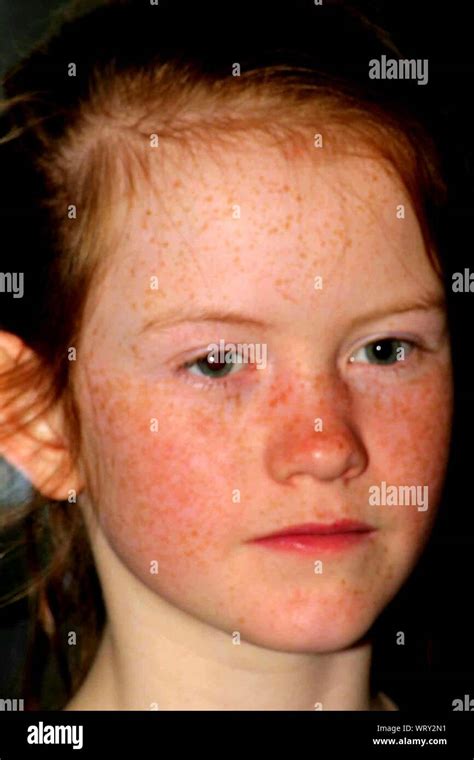 Freckle Face Girl High Resolution Stock Photography And Images Alamy