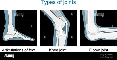 Types Of Joints Knee Joint Articulations Of Foot Elbow Joint Set