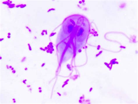 Giardia Duodenalis Causes Prevention Symptoms Diagnosis And Treatment