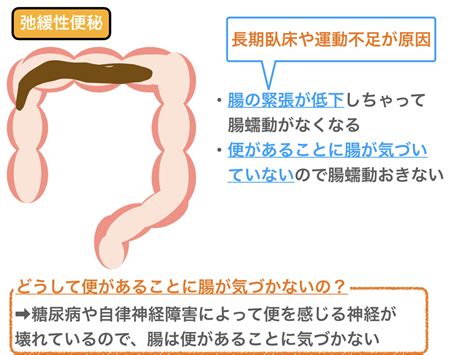 便秘の原因や病態を解説！食物繊維はどうして腸に効く？看護師国試に合格！