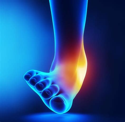 Signs Of A Sprained Ankle Errol Gindi Dpm Podiatrist