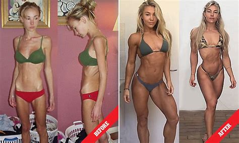 Model Whose Weight Dropped When She Had Anorexia Reveals How She
