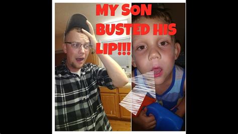 My Son Busted His Lip Youtube