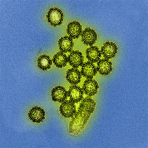 A Colorized Transmission Electron Micrograph Shows H1n1 Influenza Virus