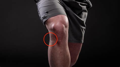 Injury Pain On Lower Outside Of Knee After Running For Minutes