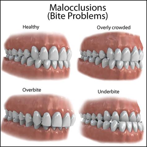 Orthodontic Related Procedures Orthodontic Related Procedures