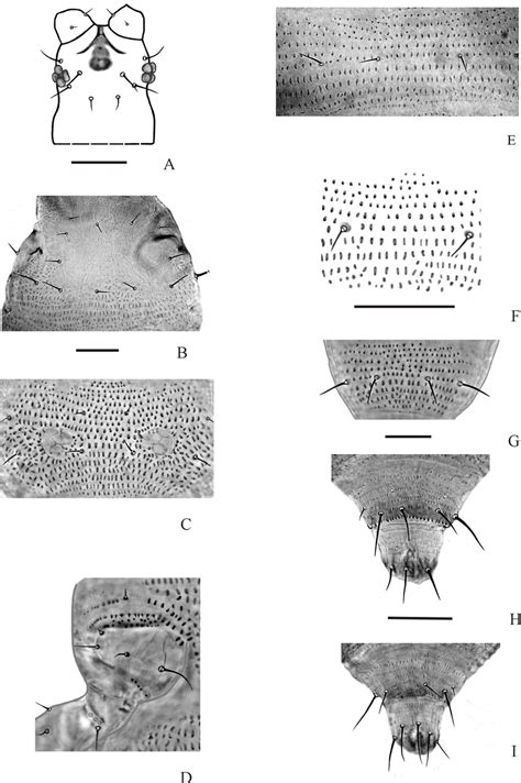 Morphology Of Thrips Nigropilosus A Head B Pronotum C