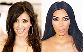 Kim Kardashian - O impressionante ANTES e DEPOIS da socialite | Nova Gente