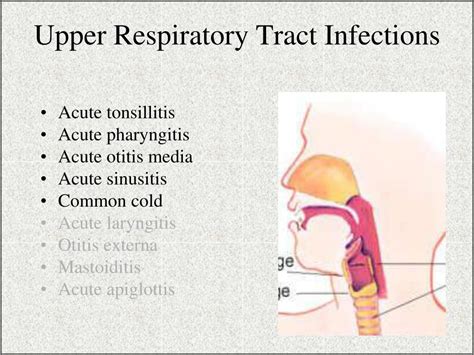 Upper respiratory infections, commonly referred to the acronym uri, is the illness caused by an acute infection which involves the upper respiratory tract: PPT - ARI PowerPoint Presentation, free download - ID:6317626