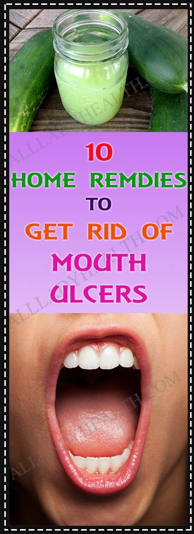Pin On Mouth Ulcers