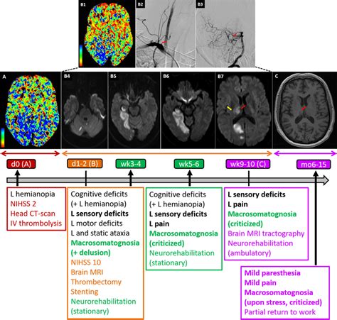 Standard Brain Imaging And Symptom Timeline Aperfusion Head Ct Scan Download Scientific