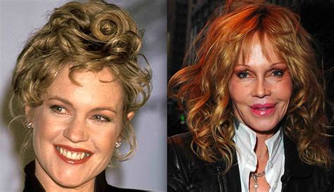 Look At The Melanie Griffith Plastic Surgery Melanie Griffith Plastic