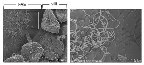 Segmented Filamentous Bacteria Sfb Scanning Electron Micrographs Of