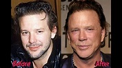 Mickey Rourke Plastic Surgery Before and After - YouTube