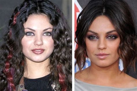 Mila Kunis Before And After Plastic Surgery Celebrity Plastic Surgery
