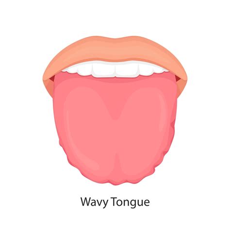 Scalloped Tongue Everything You Need To Know