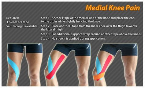 Kinesiology Taping Instructions For Medial Knee Pain Ktape Ares Knee