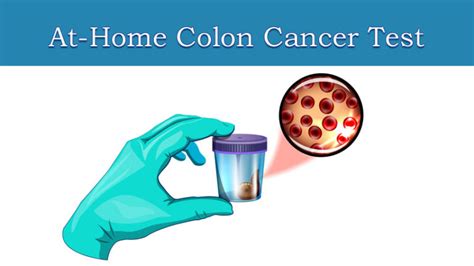 New At Home Stool Test May Be As Effective At Testing Colon Cancer As Colonoscopy Research
