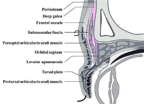 The Submuscular Fascia Which Is On The Deep Galea Plane On Lateral