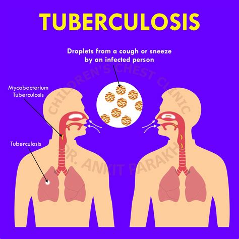 Tuberculosis What Is Tuberculosis Kncv Tuberculosefonds