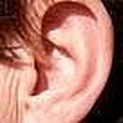 How To Treat A Popping Ear Healthy Living