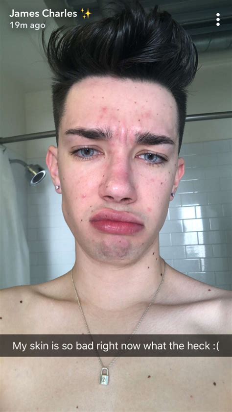Oh James If Only You Knew What My Skin Looked Like James Charles No Makeup James Charles