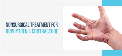 Dupuytrens Contracture Nonsurgical Treatment Xiaflex