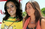 Carmen Alcayde antes y después. TRES RINOPLASTIAS y CARILLAS | ANTES DE ...
