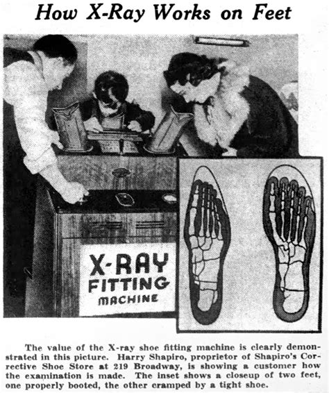 How X Ray Shoe Fittings Used To Really Be A Thing Years Ago Click