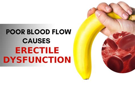 How Poor Blood Flow Causes Erectile Dysfunction How To Quickly Fix It Dr Sam Robbins