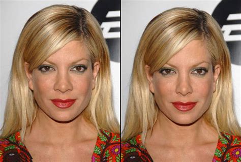 Cosmetic Surgery Connoisseur Facial Proportions Tori Spelling With A