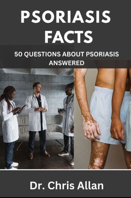 Psoriasis Facts 50 Questions About Psoriasis Answered By Dr Chris